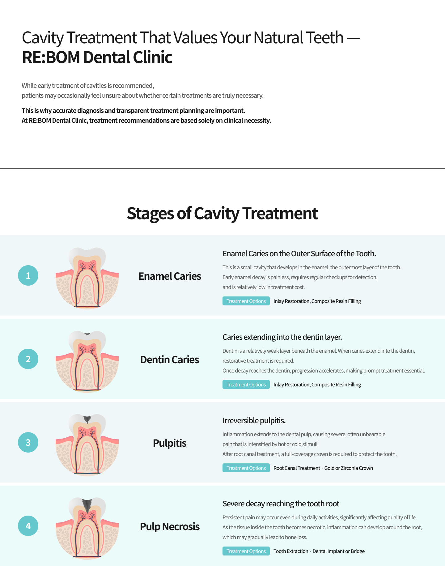 자연치아의 소중함을 아는 리봄치과 충치치료
