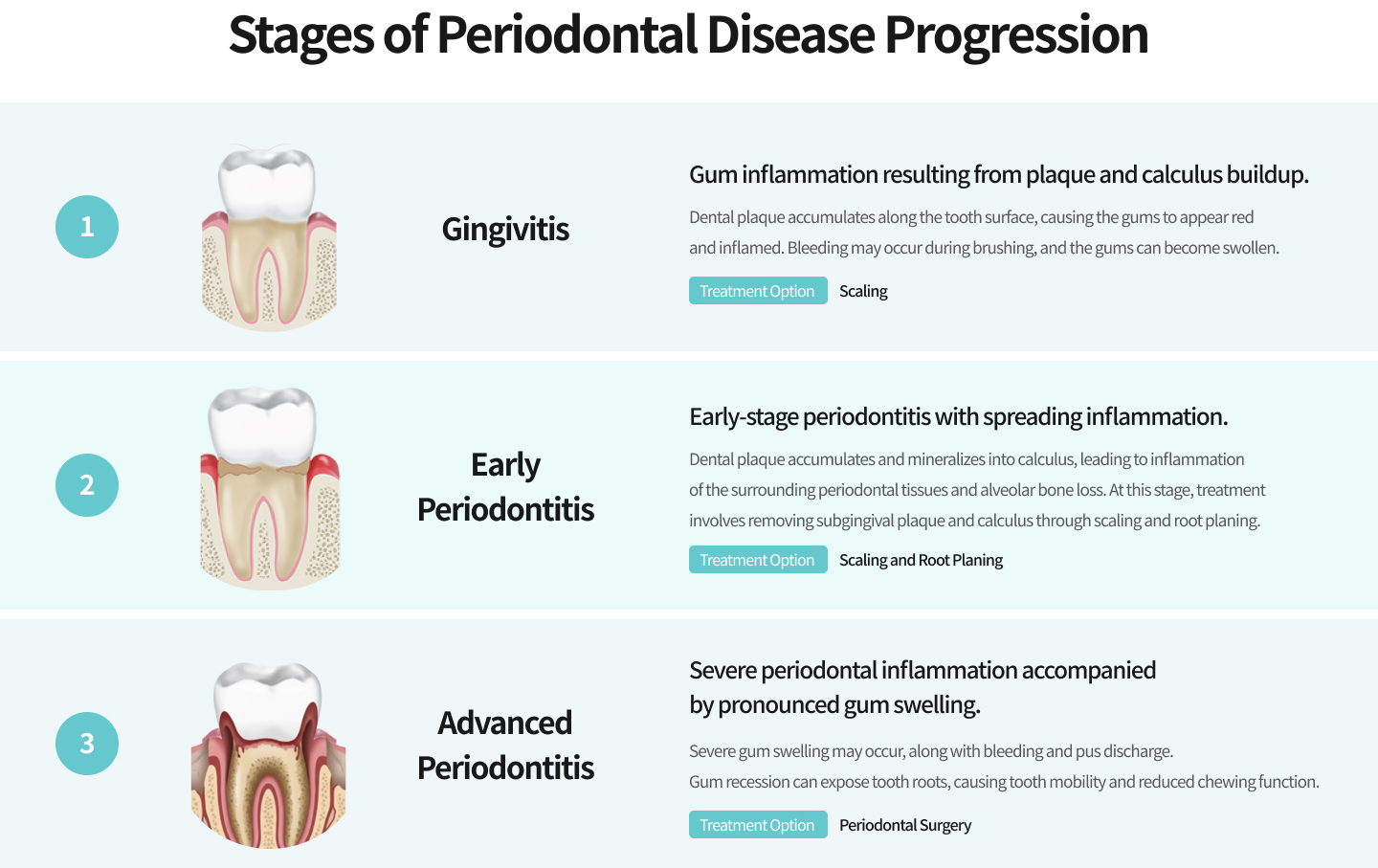 치주질환의 단계별 진행과정